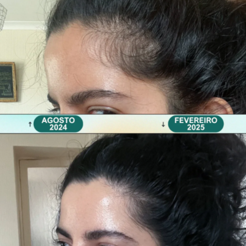 Massageador Elétrico RelaxaRaiz